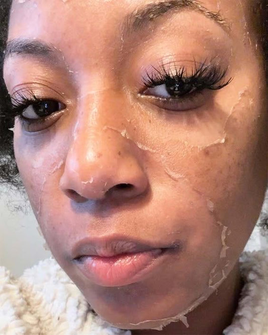 Mandelic Acid Peel + Shoulder Massage